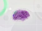 Una startup rival de Neuralink logra implantar un chip cerebral por primera vez