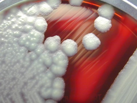 bacillus-cereus.jpg